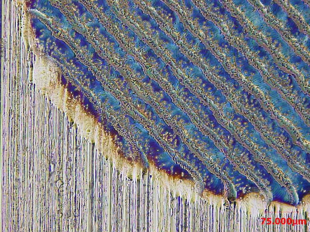 Nanosecond lasers mark stainless by a thermal process that creates a layer of dark material.