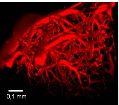 Image of the cerebral vascular system of a mouse