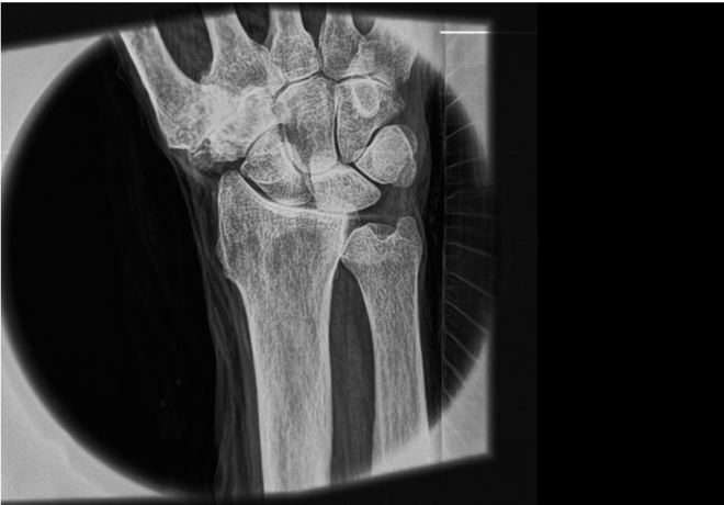 Test Device Built At MIT X Ray Dec