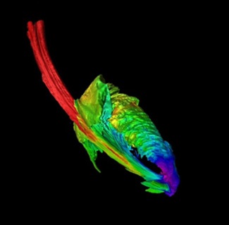 Computer simulation of the disruption of a star by a black hole shows the formation of an accretion disk of stellar material spiraling into the black hole