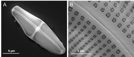 Scanning electron microscopy image of a single diatom frustule