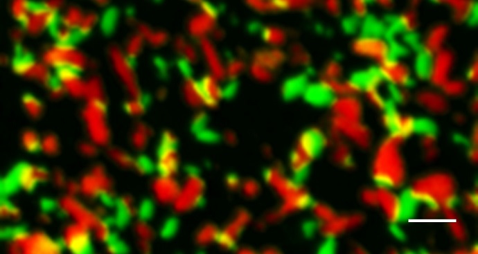 X-ray microscope snapshot of nanoparticles in a battery midway through charging