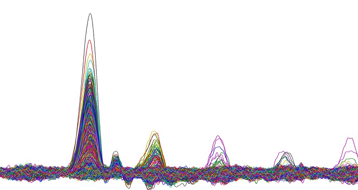 Output from a Single-Photon Detector