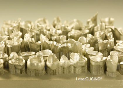 Concept Laser’s compact 3D Printer performs well in the dental industry
