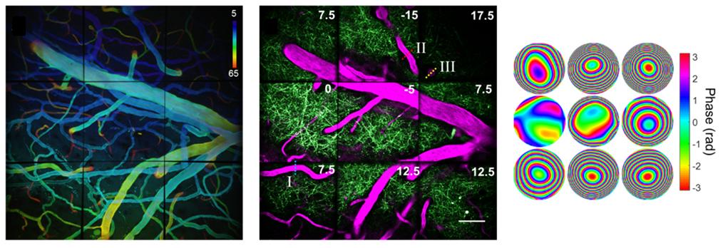 The system images voxels at rates up to 32 MHz, limited by the laser-scanning hardware